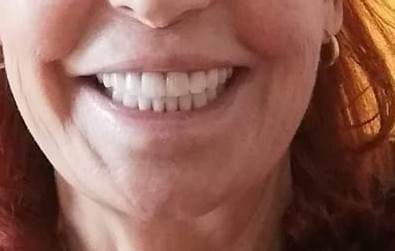 Carousel Dentiste étranger